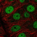 Immunofluorescent staining of human cell line MCF7 shows localization to nucleoplasm.