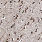 Anti-HSP90B1 Antibody