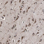Anti-HSP90B1 Antibody