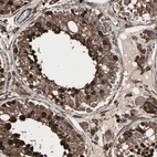 Immunohistochemical staining of human testis shows strong cytoplasmic positivity in cells in seminiferous ducts and Leydig cells.