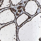 Immunohistochemical staining of human thyroid gland shows strong cytoplasmic positivity in glandular cells.