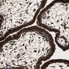 Immunohistochemical staining of human placenta shows strong cytoplasmic positivity in trophoblastic cells.