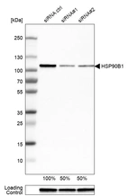 Western blot analysis in U-251MG cells transfected with control siRNA, target specific siRNA probe #1 and #2, using Anti-HSP90B1 antibody. Remaining relative intensity is presented. Loading control: Anti-GAPDH.