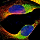 Immunofluorescent staining of human cell line U-2 OS shows localization to endoplasmic reticulum.