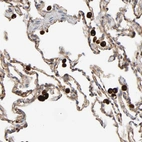 Immunohistochemical staining of human lung shows strong cytoplasmic positivity in macrophages.