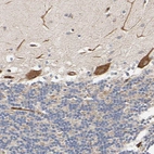 Immunohistochemical staining of human cerebellum shows strong cytoplasmic positivity in Purkinje cells.