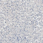 Immunohistochemical staining of human liver shows no positivity in hepatocytes as expected.