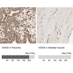 Anti-VSIG4 Antibody