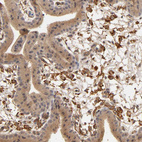 Immunohistochemical staining of human placenta shows moderate to strong positivity in Hofbauer cells.