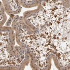 Anti-VSIG4 Antibody