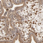 Immunohistochemical staining of human placenta shows moderate to strong positivity in Hofbauer cells.