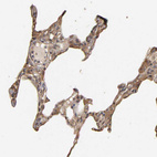 Immunohistochemical staining of human lung shows moderate to strong cytoplasmic positivity in macrophages.