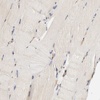 Immunohistochemical staining of human skeletal muscle shows no positivity in myocytes as expected.