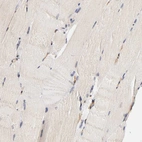 Immunohistochemical staining of human skeletal muscle shows no positivity in myocytes as expected.