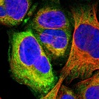 Anti-GPR173 Antibody