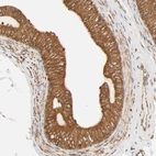 Immunohistochemical staining of human epididymis shows high expression.