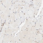 Anti-BCAP31 Antibody