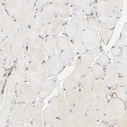 Immunohistochemical staining of human skeletal muscle shows low expression as expected.
