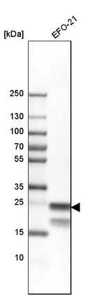 Western blot analysis in human cell line EFO-21.