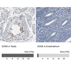 Anti-SOX6 Antibody