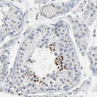 Anti-SOX6 Antibody