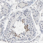 Immunohistochemical staining of human testis shows strong nuclear positivity in spermatids.