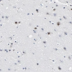 Immunohistochemical staining of human cerebral cortex shows moderate nuclear positivity in neurons.