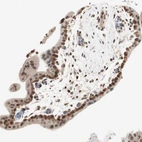 Immunohistochemical staining of human placenta shows moderate to strong nuclear positivity in trophoblastic cells.