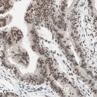 Immunohistochemical staining of human fallopian tube shows moderate to strong nuclear positivity in glandular cells.
