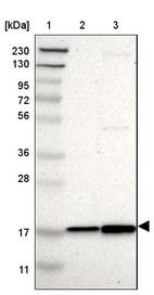Lane 1: Marker [kDa] 230, 130, 95, 72, 56, 36, 28, 17, 11_br/_Lane 2: Human cell line RT-4_br/_Lane 3: Human cell line U-251MG sp