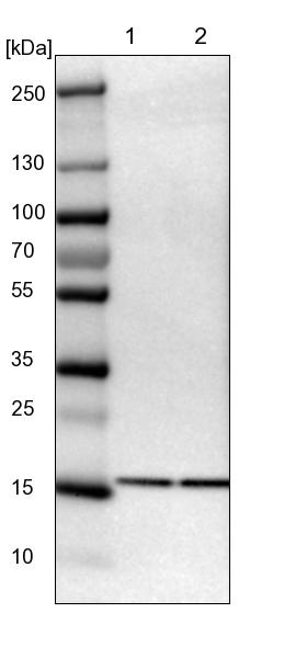 Rabbit Polyclonal AntiUBE2I Antibody Buy for research Highly