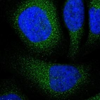 Immunofluorescent staining of human cell line U-2 OS shows localization to cytosol.