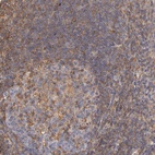 Anti-FCMR Antibody
