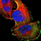 Immunofluorescent staining of human cell line U-251 MG shows localization to cytosol & focal adhesion sites.