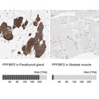 Anti-PPFIBP2 Antibody