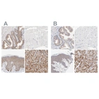 Immunohistochemical staining of human prostate, skeletal muscle, skin and stomach using Anti-PPFIBP2 antibody HPA003911 (A) shows similar protein distribution across tissues to independent antibody HPA001935 (B).