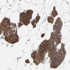 Immunohistochemical staining of human parathyroid gland shows strong cytoplasmic positivity in glandular cells.