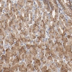Immunohistochemical staining of human stomach shows moderate cytoplasmic positivity in glandular cells.