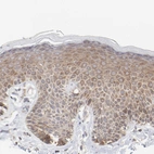 Immunohistochemical staining of human skin shows weak cytoplasmic positivity in squamous epithelial cells.