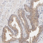 Immunohistochemical staining of human prostate shows moderate cytoplasmic positivity in glandular cells.