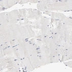 Immunohistochemical staining of human skeletal muscle shows no positivity in myocytes as expected.