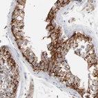 Anti-ITPR3 Antibody