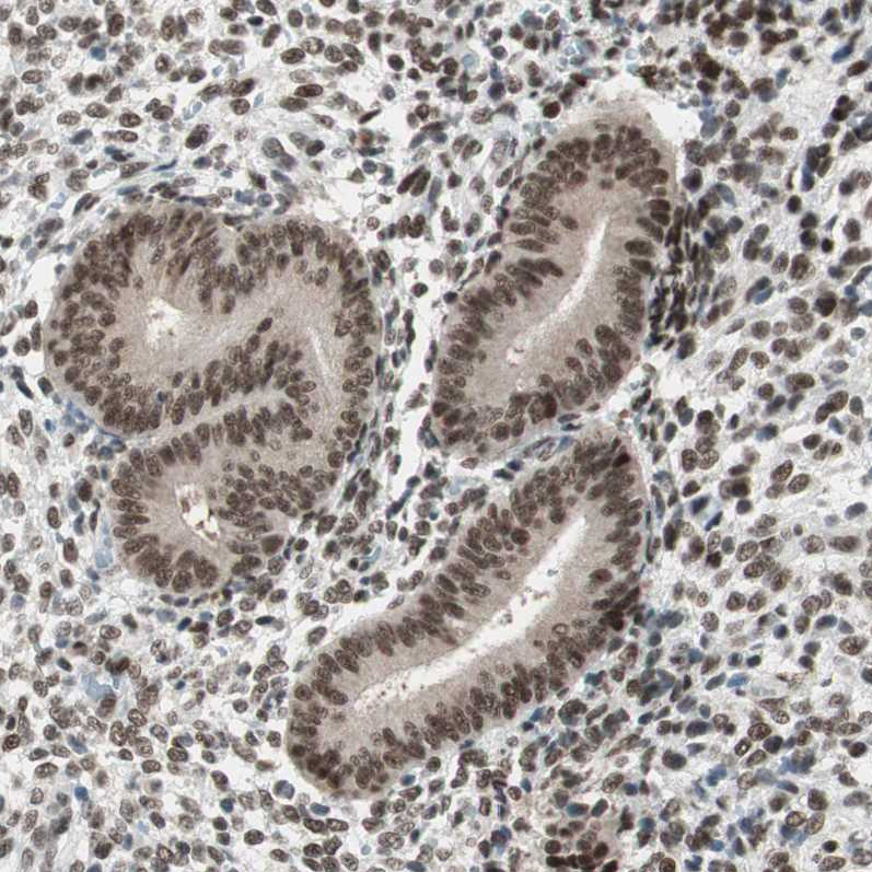 Anti-SMARCE1 Antibody