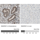 Anti-SMARCE1 Antibody