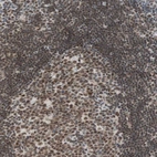 Immunohistochemical staining of human endometrium shows high expression.