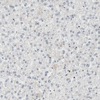 Immunohistochemical staining of human liver shows low expression as expected.