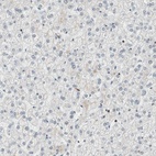 Anti-SMARCE1 Antibody