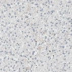 Immunohistochemical staining of human liver shows low expression as expected.