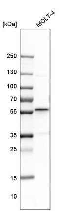 Anti-SMARCE1 Antibody