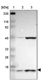 Lane 1: Marker [kDa] 230, 110, 82, 49, 32, 26, 18_br/_Lane 2: Human cell line RT-4_br/_Lane 3: Human cell line U-251MG sp